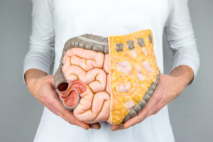 Inflammatory Bowel Diseases